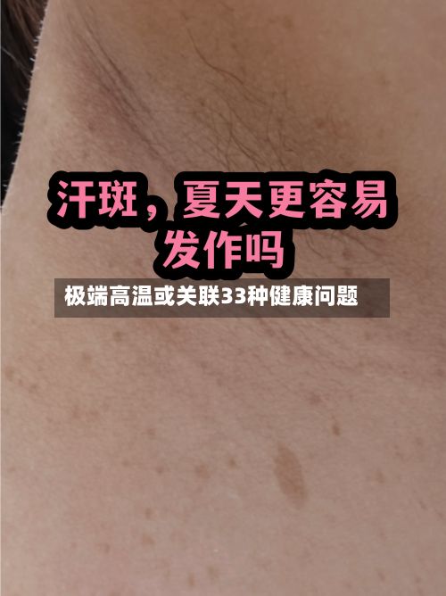 极端高温或关联33种健康问题