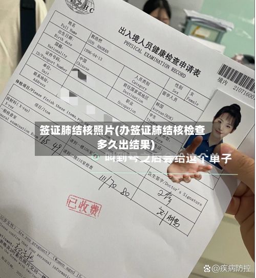 签证肺结核照片(办签证肺结核检查多久出结果)-第3张图片